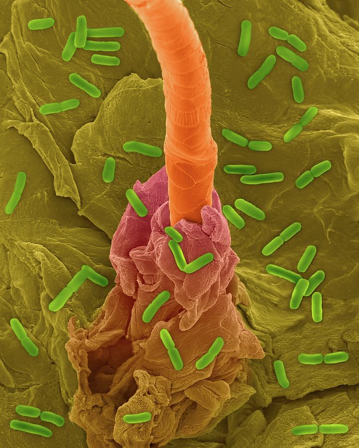 Bacillus Photograph - E. Coli On Human Skin And Hair Follicle #2 by Dennis Kunkel Microscopy/science Photo Library