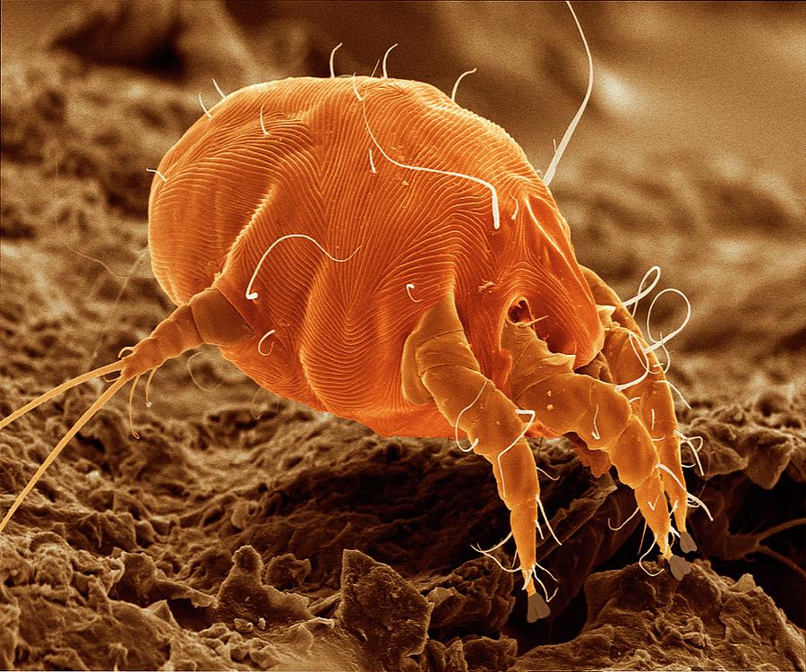 Ear Mite (otodectes Cynotis) #2 Photograph by Power And Syred