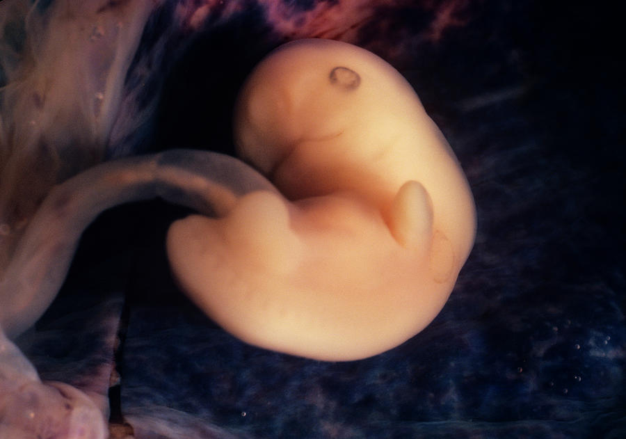 embryo-at-six-weeks-photograph-by-dopamine-science-photo-library