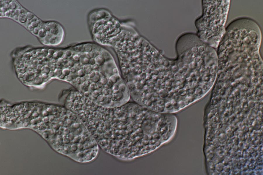 Entamoeba Histolytica Photograph - Entamoeba Histolytica Protozoa #2 by Sinclair Stammers