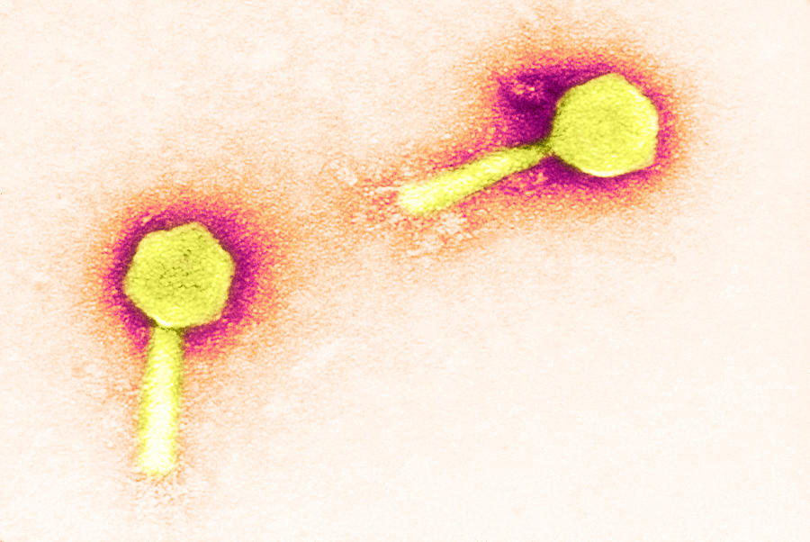 Enteriobacteria Phage P1, Tem #2 Photograph by Biology Pics