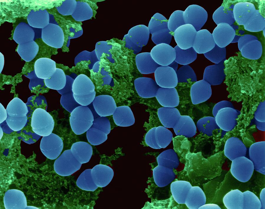 Enterococcus Faecium Photograph By Dennis Kunkel Microscopyscience