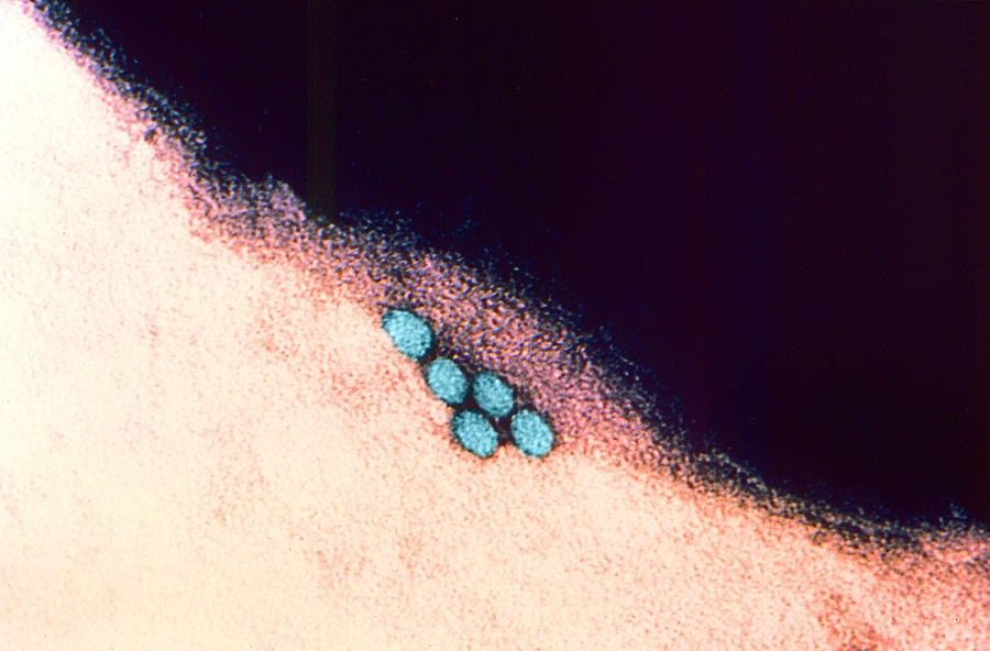 Enterovirus, Tem #2 Photograph by Science Source