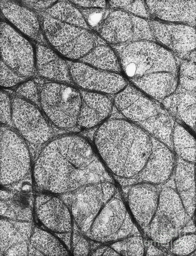 Epithelial Cell From Cervix, Tem #2 Photograph by David M. Phillips