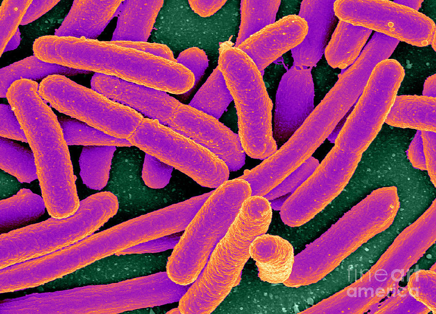 Escherichia Coli Bacteria, Sem #2 Photograph by Science Source