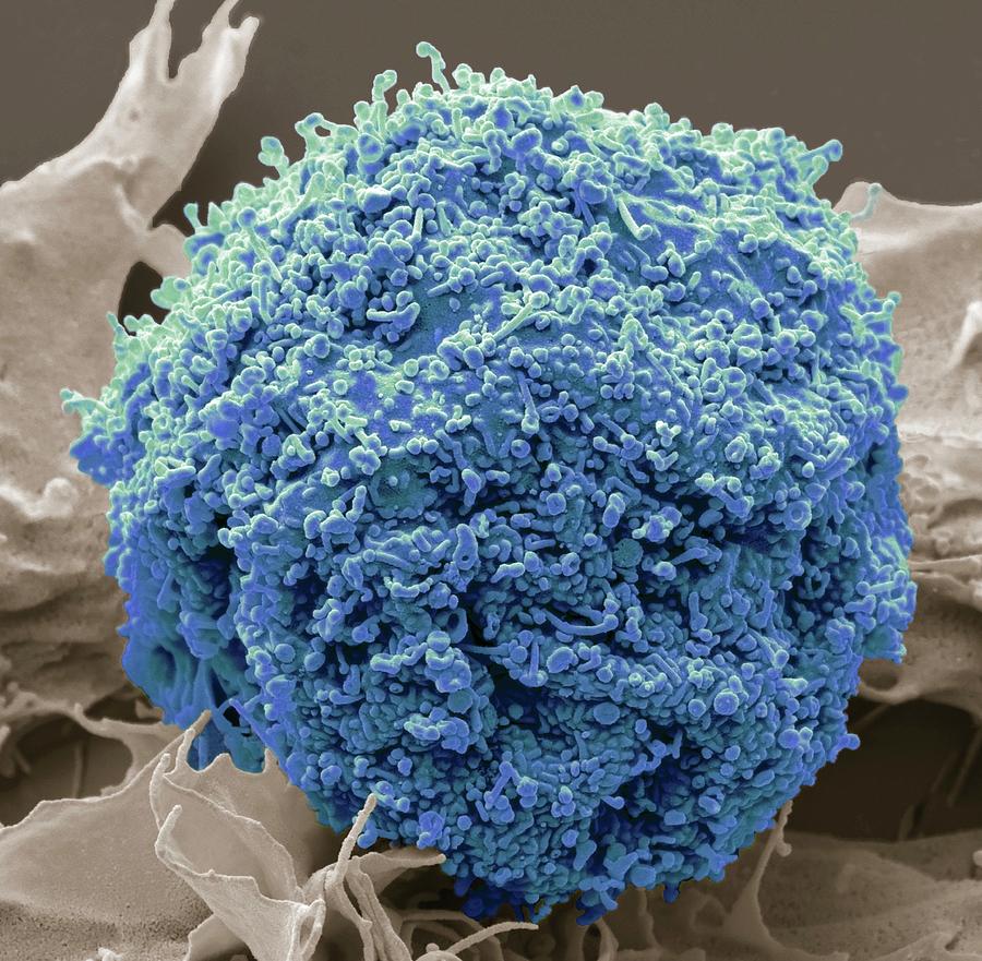 Exosomes Photograph by Steve Gschmeissner/science Photo Library - Fine ...