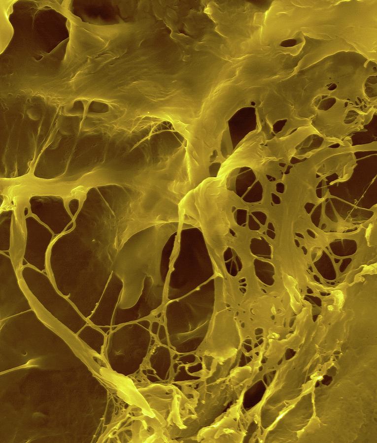 Extracellular Matrix #2 Photograph by Dennis Kunkel Microscopy/science Photo Library