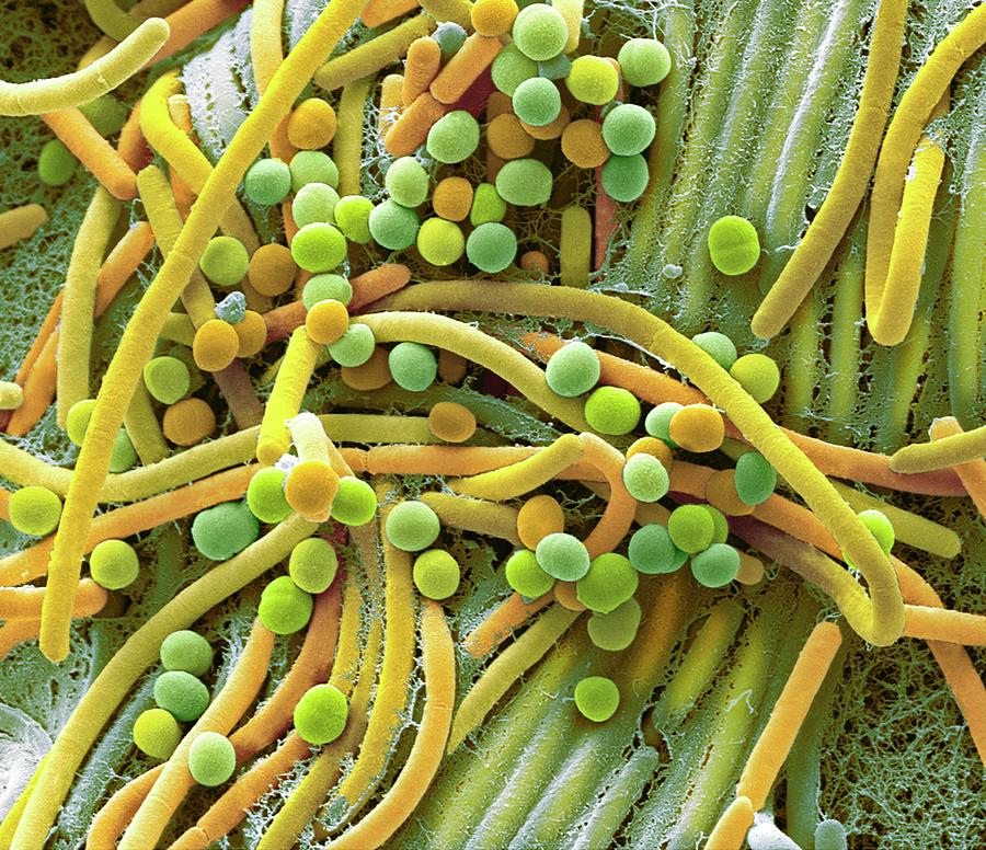 Бактерии сапрофиты фото