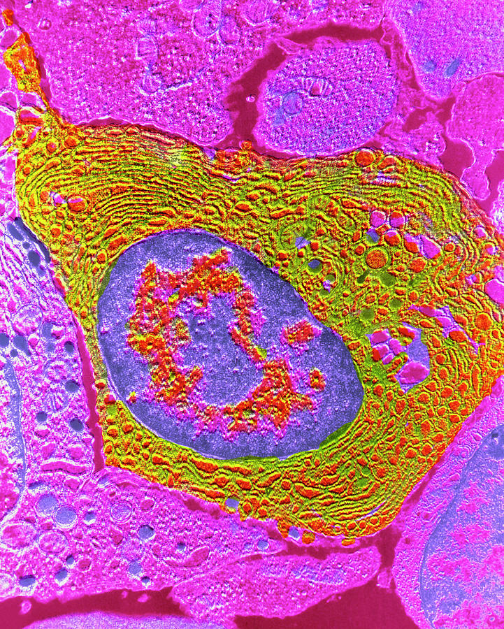 False-colour Tem Of A Human Plasmocyte Photograph by Cnri/science Photo ...