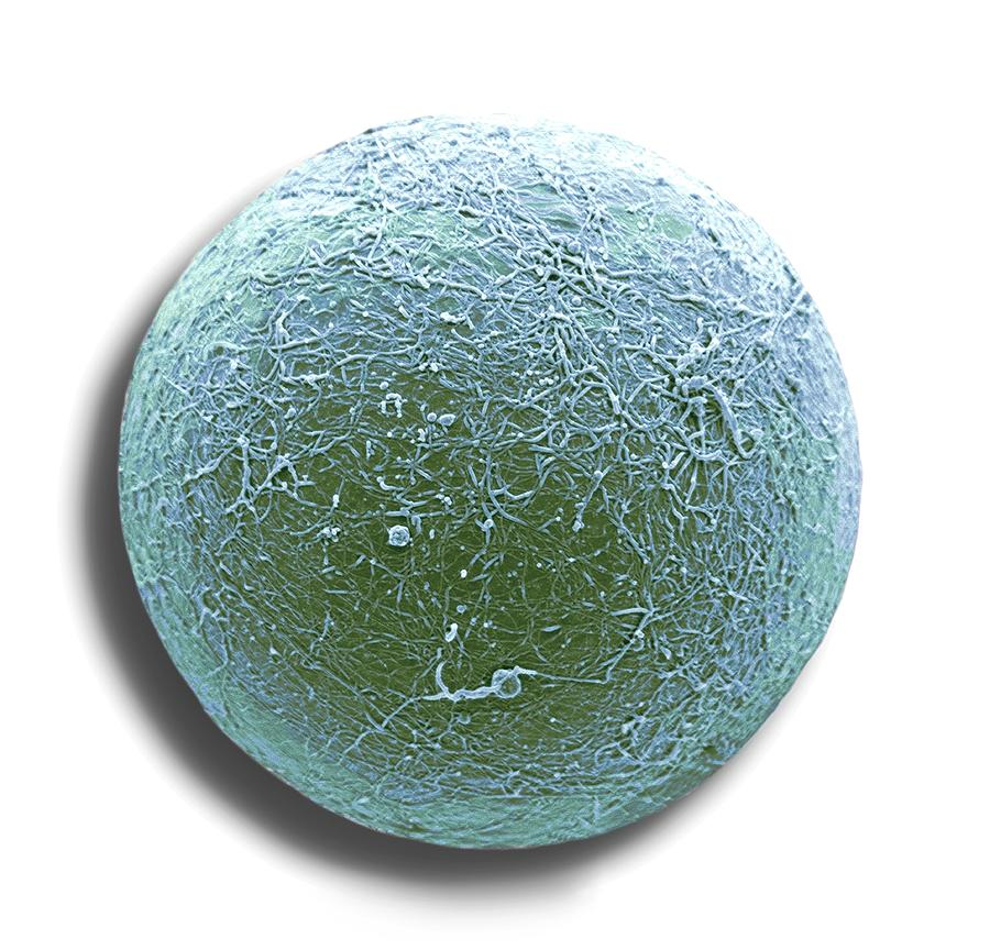 Fat Cell #2 Photograph by Steve Gschmeissner/science Photo Library