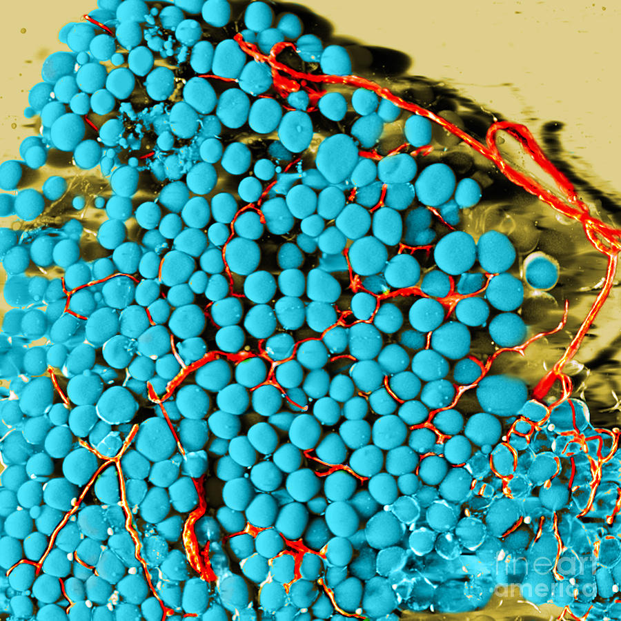 Fat Cells And Blood Vessels, Sem #2 Photograph by Science Source