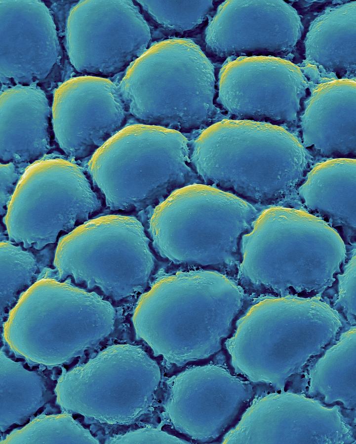 Fat Cells From Adipose Tissue #2 Photograph by Dennis Kunkel Microscopy/science Photo Library