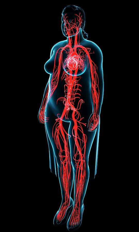 Illustration Photograph - Female Vascular System #2 by Pixologicstudio/science Photo Library
