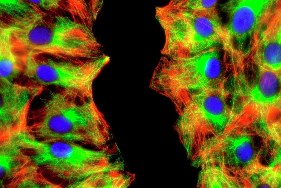 Fibroblast Cells #2 Photograph by Dr Jan Schmoranzer/science Photo Library