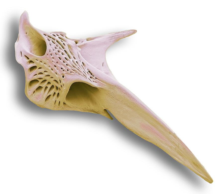 Fish Photograph - Fish Skull Bone #2 by Steve Gschmeissner/science Photo Library