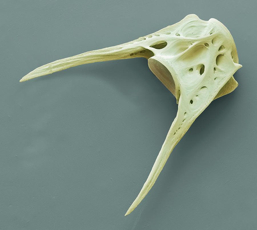 Fish Vertebra #2 Photograph by Steve Gschmeissner/science Photo Library ...