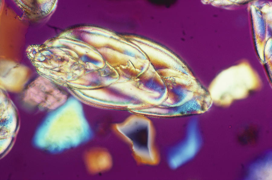 Foraminifera Lm #2 Photograph by Charles Gellis