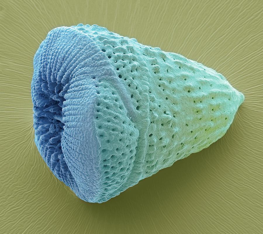 Foraminiferan Microfossil #2 Photograph by Steve Gschmeissner