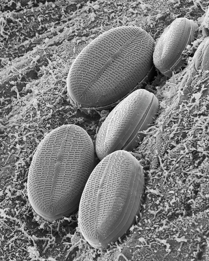 Fresh Water Pennate Diatom #2 Photograph by Dennis Kunkel Microscopy/science Photo Library