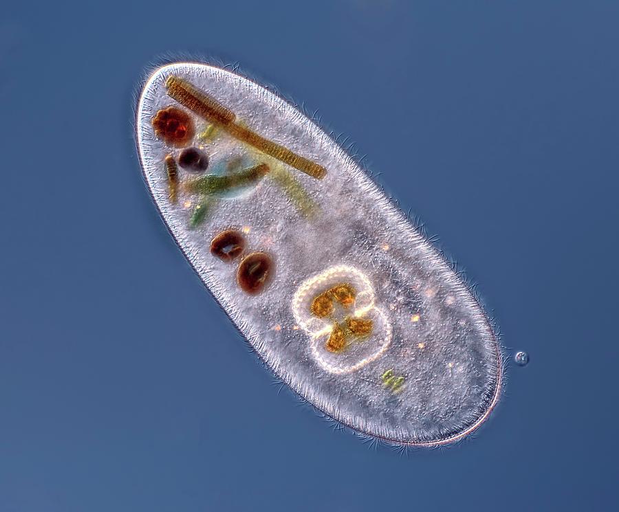 Frontonia Sp. Protist #2 Photograph by Rogelio Moreno/science Photo Library