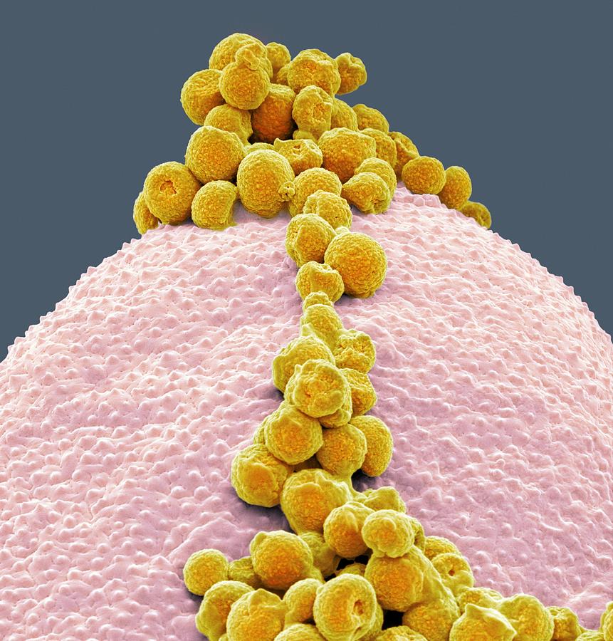 Fungal Spores. Spore and pollen. Yellow fungus Art Spores. Pollen Grains: © PSU Entomology/photo researchers. Пыльца и споры