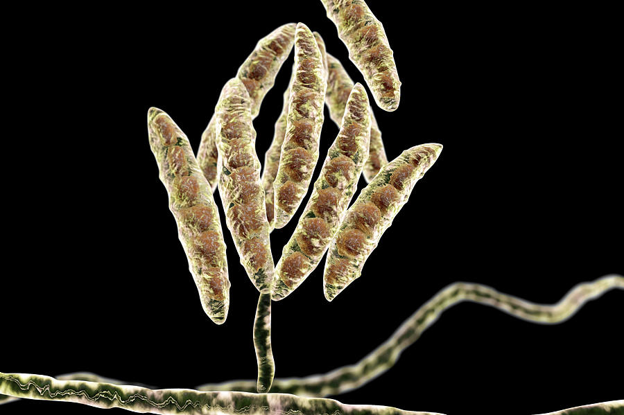 Fusarium Fungus Conidia Photograph By Kateryna Konscience Photo Library Pixels 