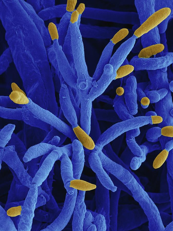 Fusarium Incarnatum Pathogenic Fungus #2 Photograph by Dennis Kunkel Microscopy/science Photo Library
