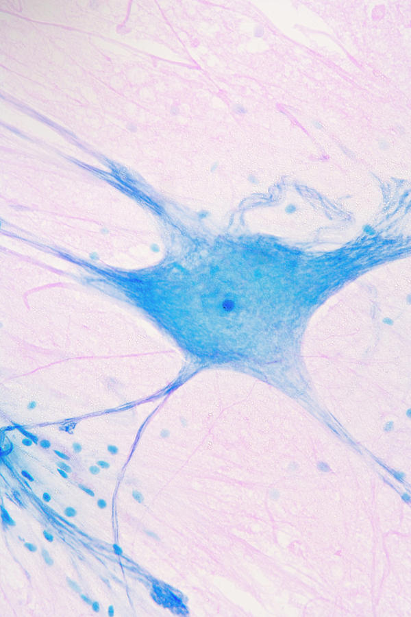 Giant Multipolar Neuron And Glial Cells #2 Photograph by Science Stock Photography/science Photo Library