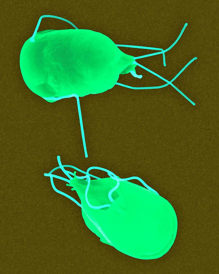 Animal Photograph - Giardia Lamblia Parasitic Protozoan #2 by Dennis Kunkel Microscopy/science Photo Library