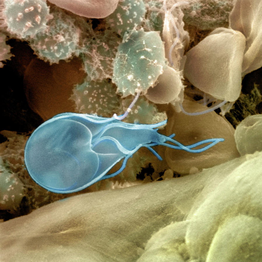 Giardia Lamblia Protozoan Photograph By Dr Tony Brainscience Photo Library Fine Art America 1713