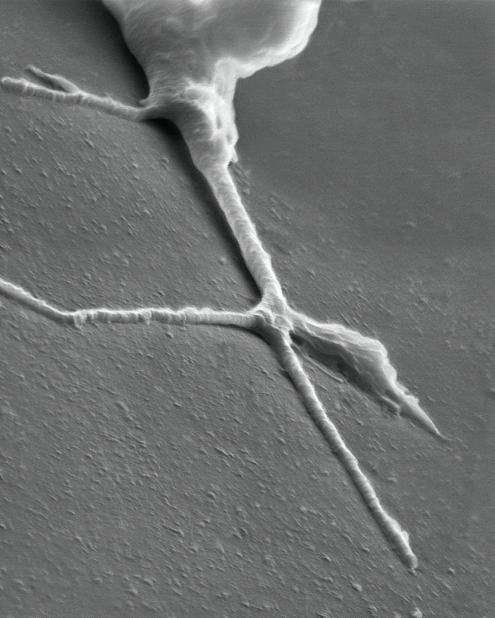 Growth Cone From A Developing Neuron #2 Photograph by Dennis Kunkel Microscopy/science Photo Library