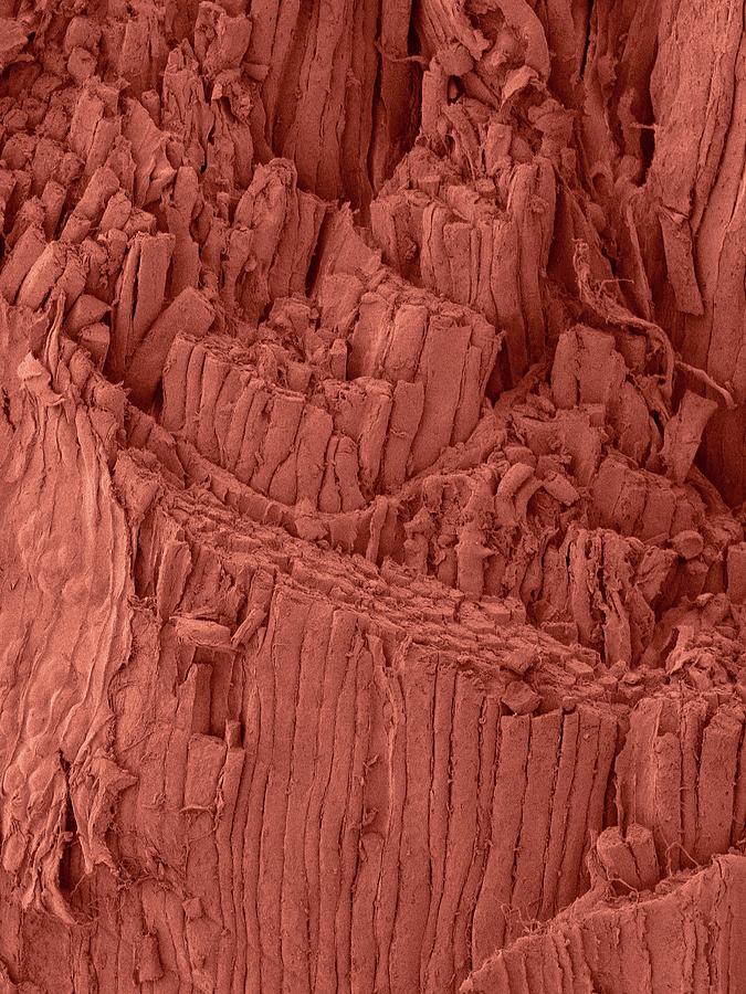 Ham Shank Muscle Fibres #2 Photograph by Dennis Kunkel Microscopy/science Photo Library