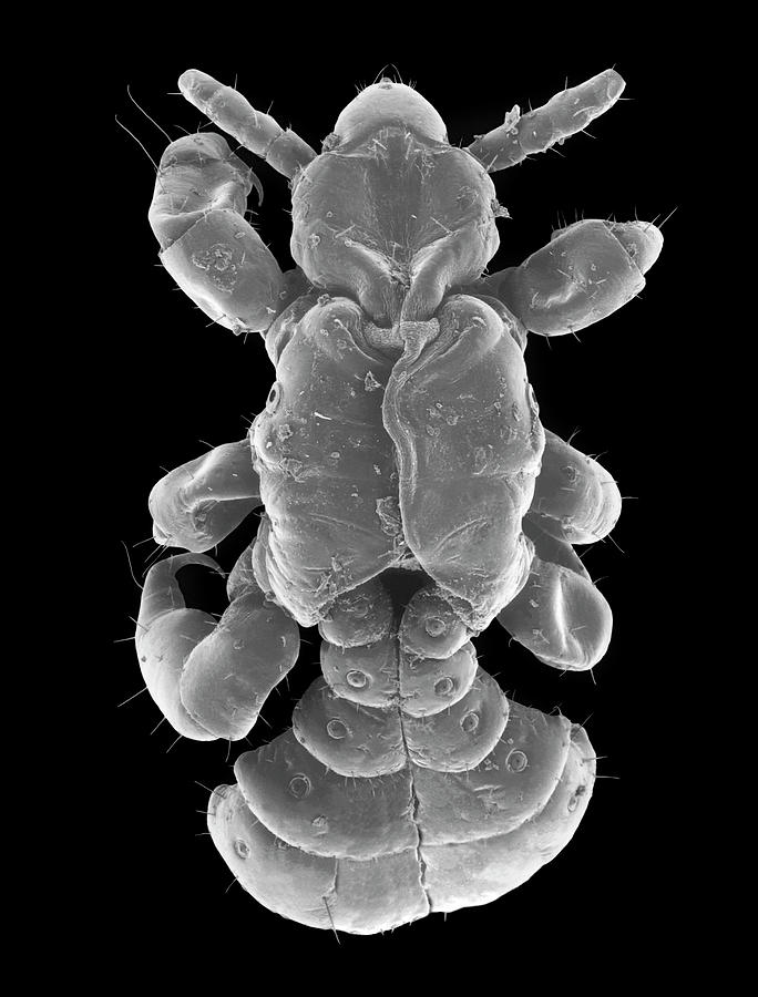 Head Louse Photograph by Dennis Kunkel Microscopy/science Photo Library ...