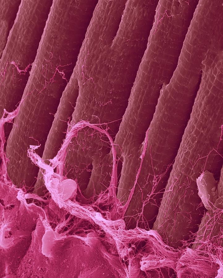 Heart Muscle Fibres  #2 Photograph by Dennis Kunkel Microscopy/science Photo Library
