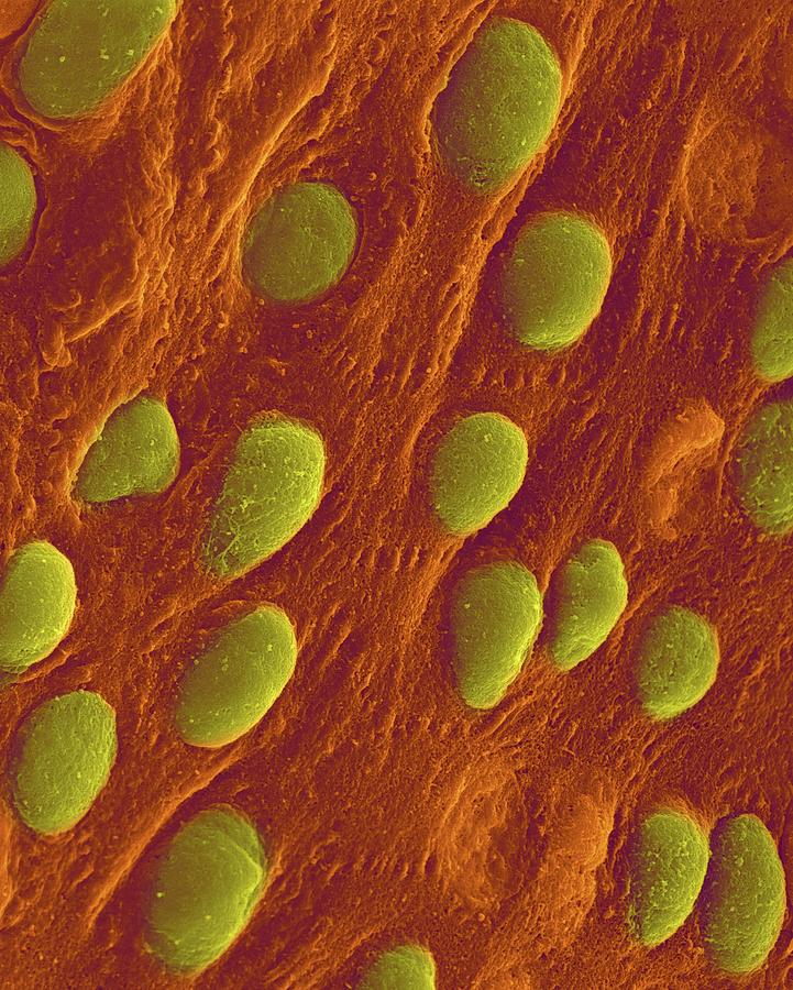 Heart Pericardium Surface #2 Photograph by Dennis Kunkel Microscopy/science Photo Library