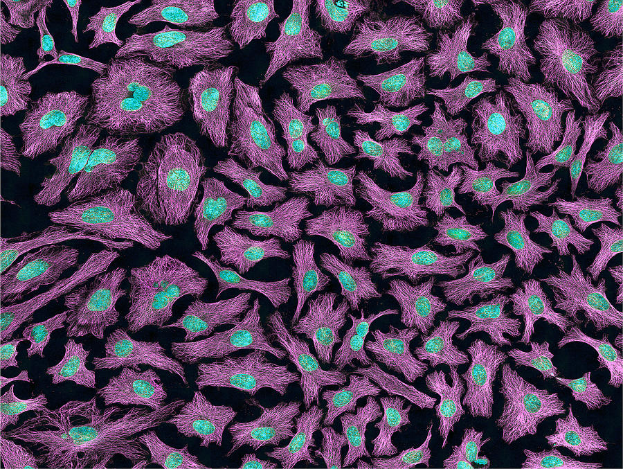 Hela Cells, Mfm #2 Photograph by Science Source