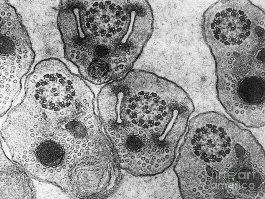 Hemiptera Sperm Tem #2 Photograph by David M. Phillips