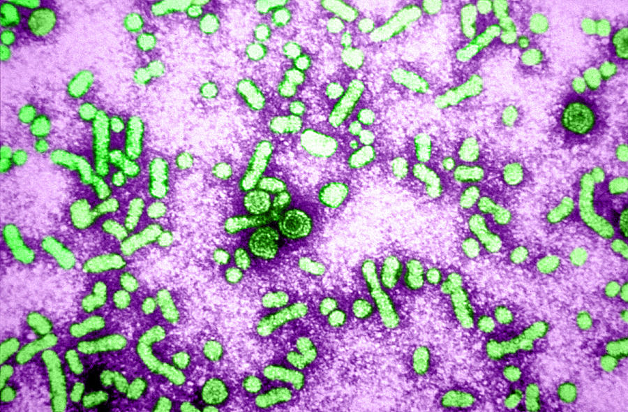 Hepatitis-b Virus, Tem #2 Photograph by Science Source