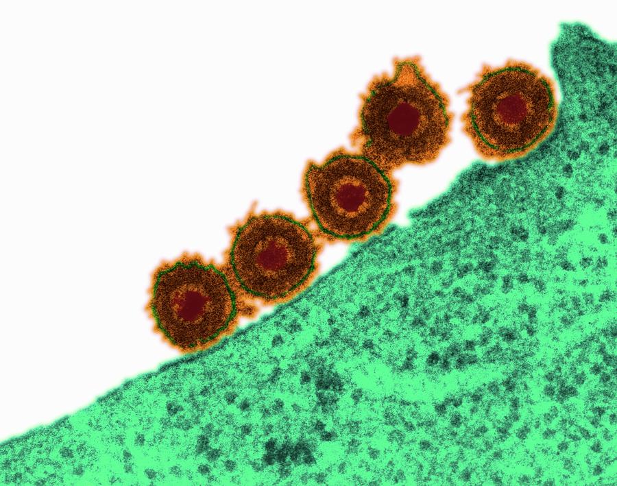 Virus Herpes Simplex Tip 1 Hsv1 Anticorpi Igg Herpes Simplex Virus Photograph by Dennis Kunkel Microscopy/science