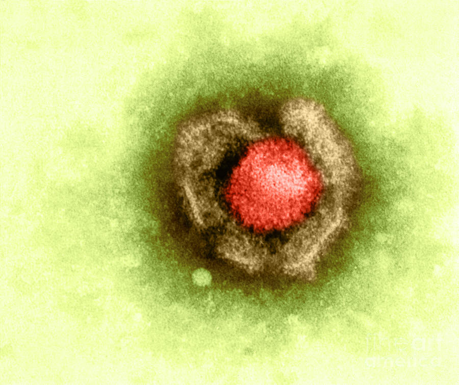 Barr Photograph - Herpes Simplex Virus #3 by Kwangshin Kim