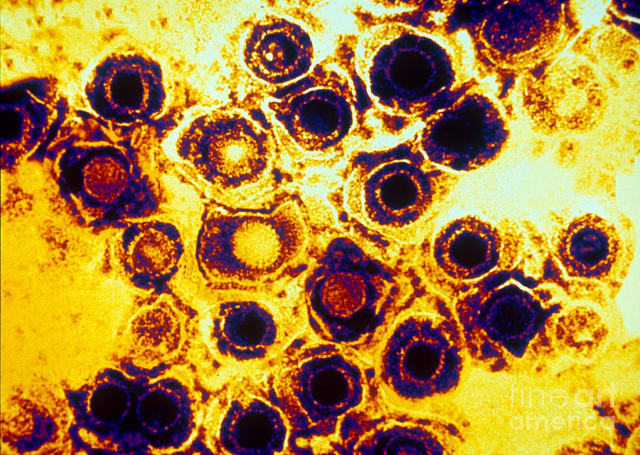 Herpes Simplex Virus Tem #2 Photograph by Scott Camazine