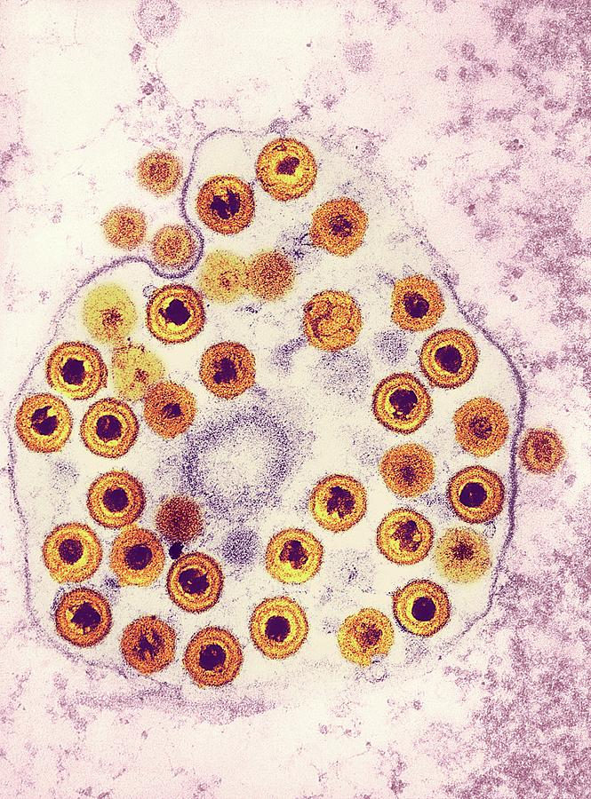 Herpes Virus Particles Photograph by Ami Images/science Photo Library ...