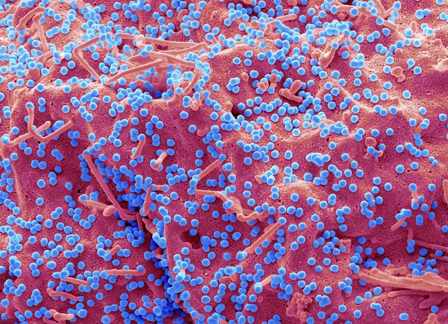 Hiv Infected 293t Cell Photograph by Steve Gschmeissner/science Photo