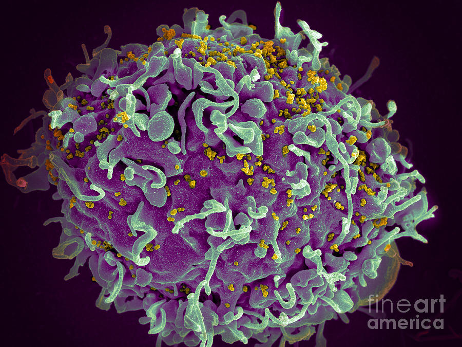 Hiv, T Cell Under Attack, Sem #2 Photograph by Science Source