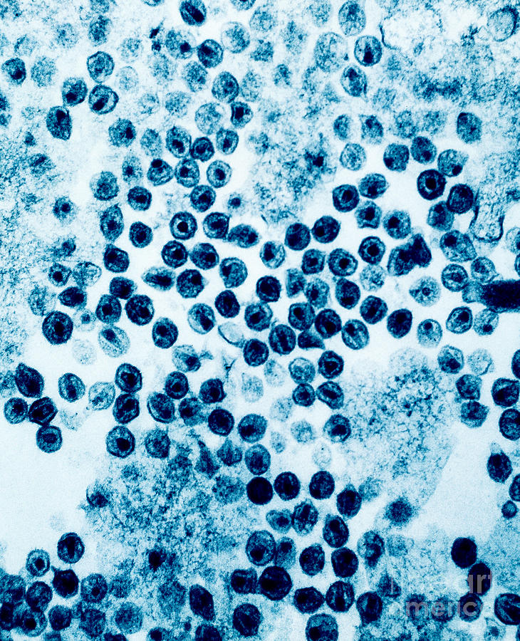 Hiv Virus #2 Photograph by David M. Phillips