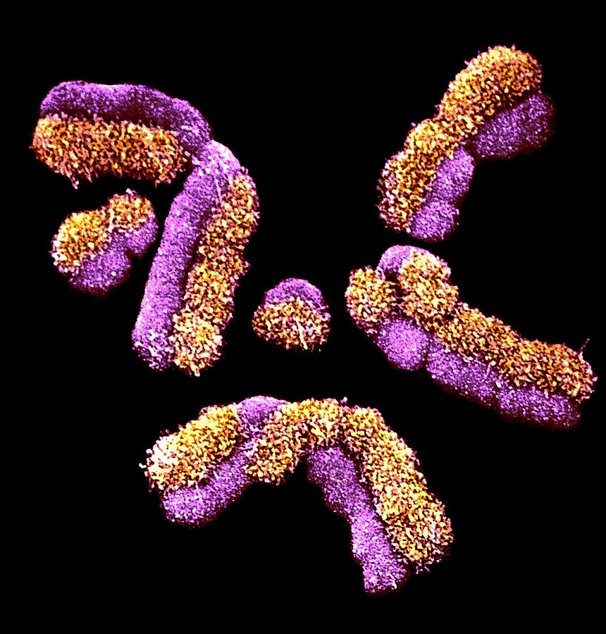 Human chromosomes, SEM #2 Photograph by Science Photo Library