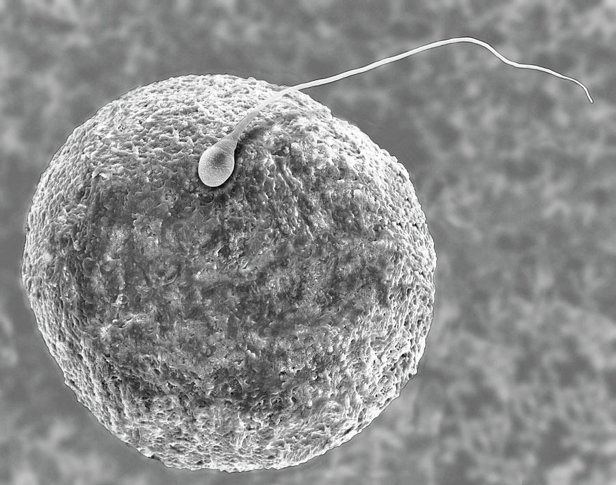 Human Egg And Sperm Photograph By Dennis Kunkel Microscopyscien