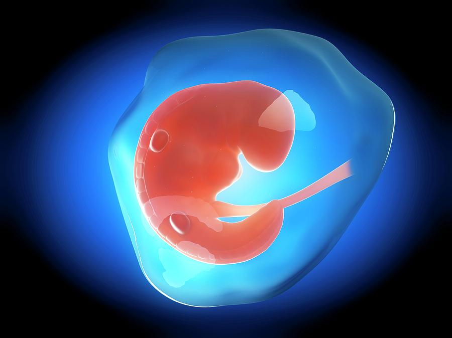 Human Fetus At 1 Month #2 Photograph by Sebastian Kaulitzki