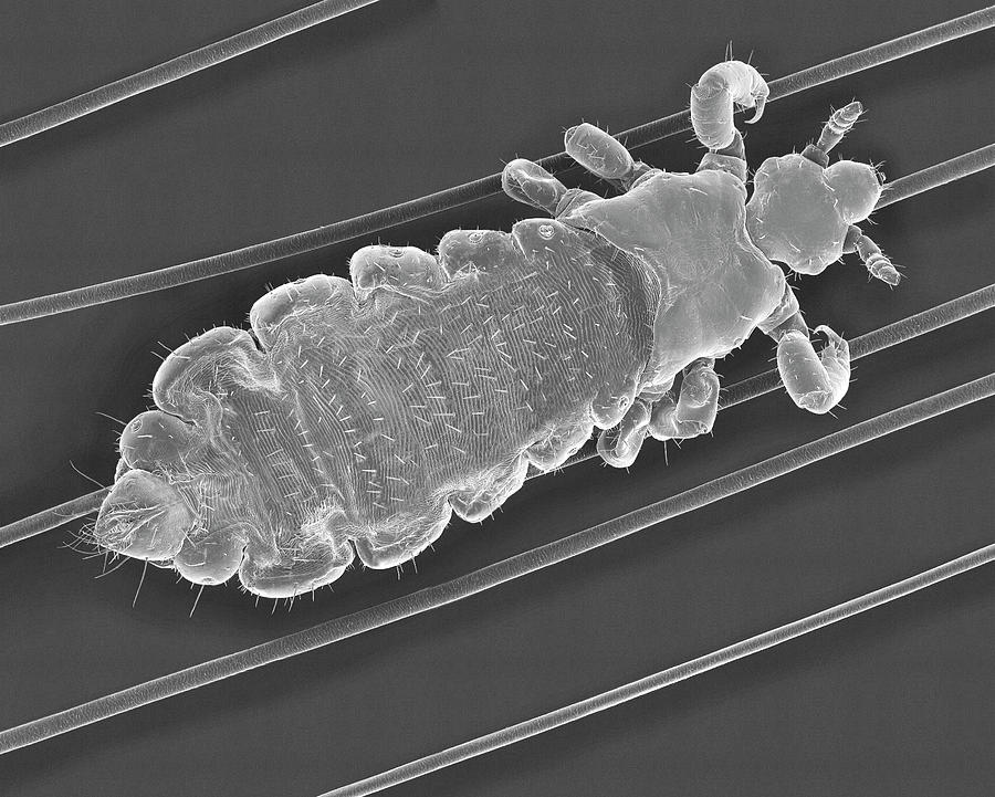 Insects Photograph - Human Head Louse On Human Hair #2 by Dennis Kunkel Microscopy/science Photo Library