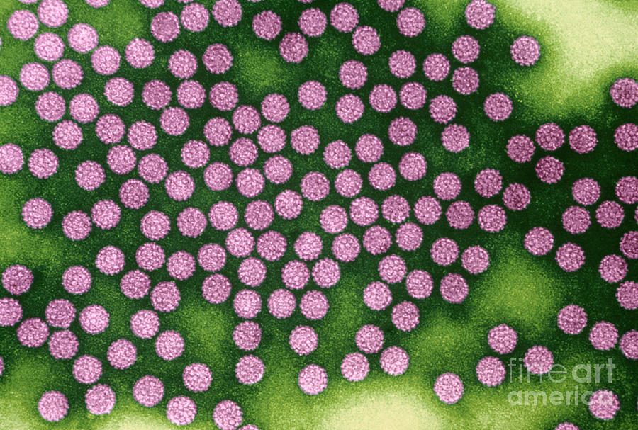 Tem Photograph - Human Papillomavirus #2 by Kwangshin Kim